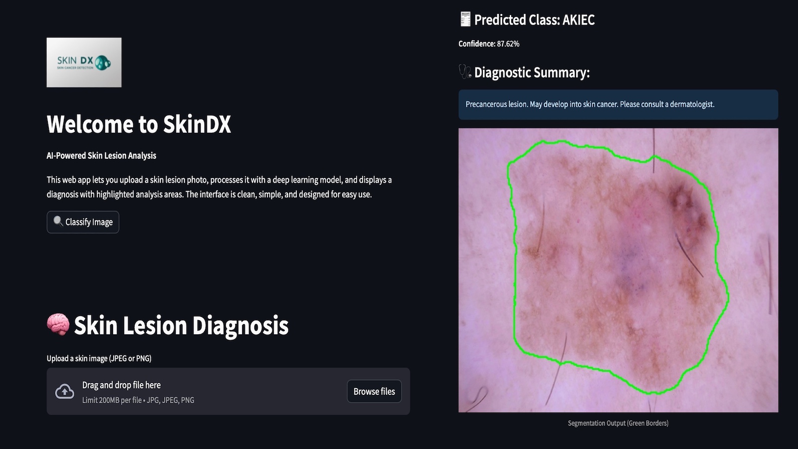 SkinDx app screenshot